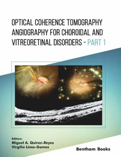 Optical Coherence Tomography Angiography for Choroidal and Vitreoretinal Disorders - Part 1 Cover